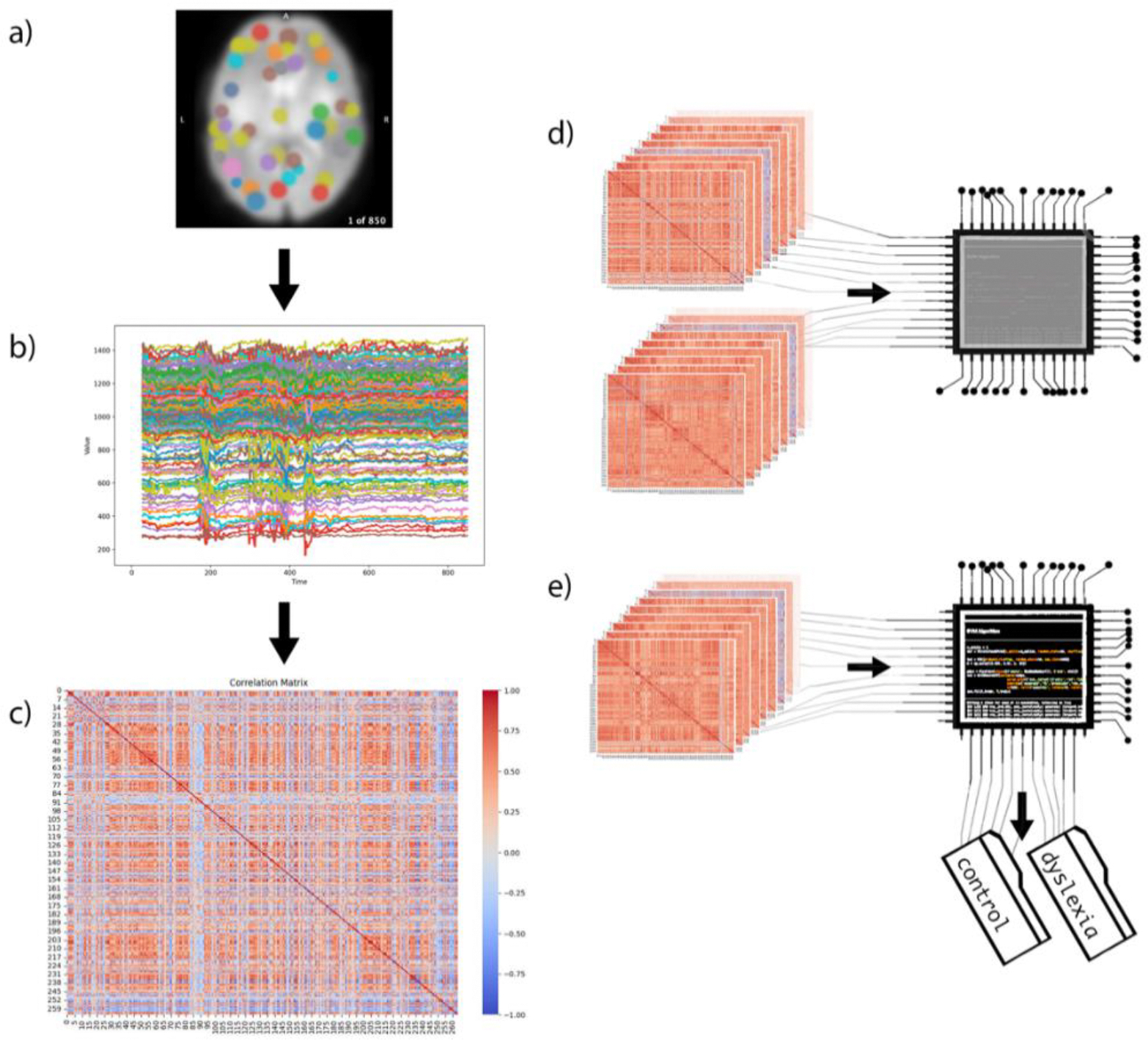 Research pipeline showing resting-state fMRI signals, connectivity matrices, and machine learning classification